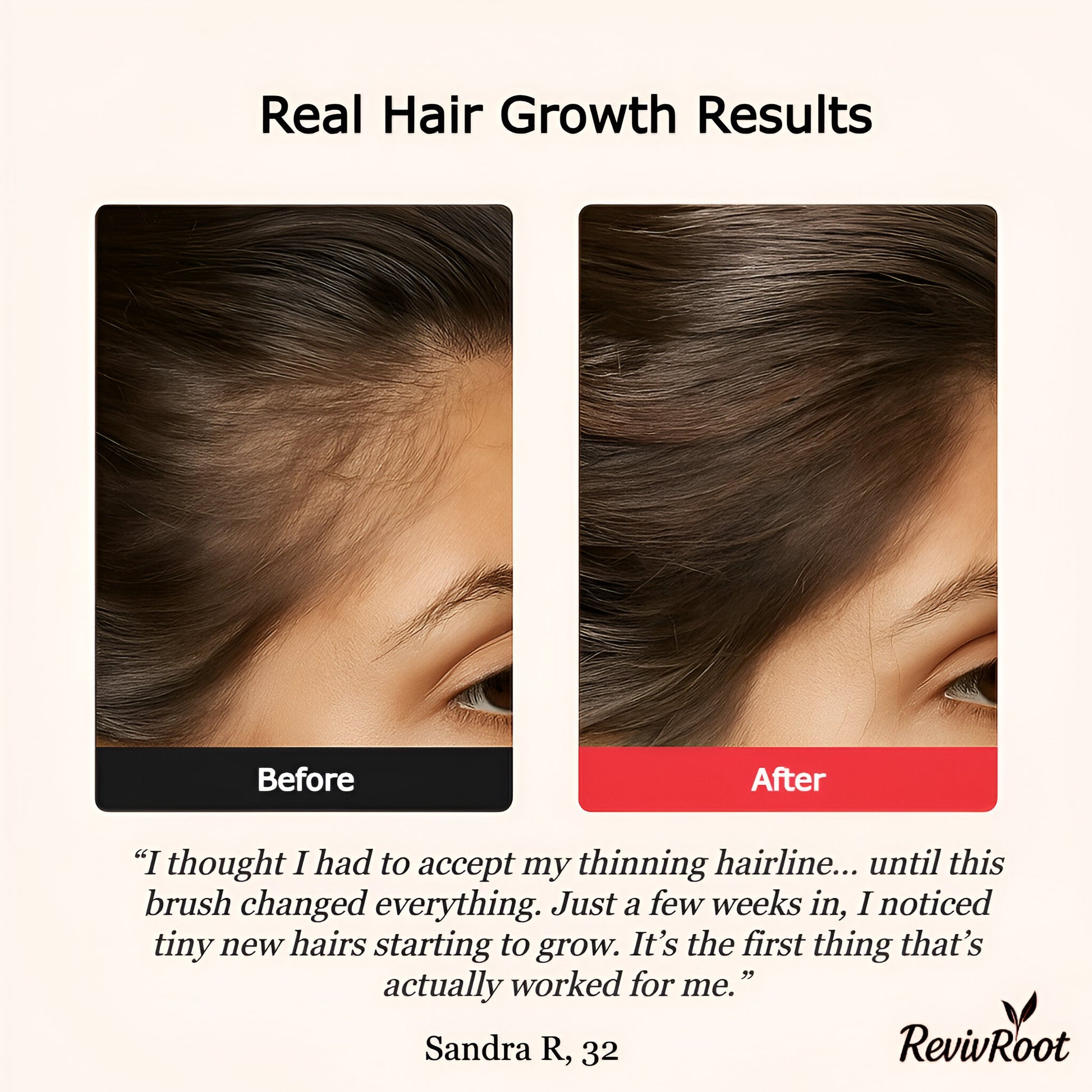 Hair growth before and after using red light scalp brush – RevivRoot testimonial image with visible results after 4 weeks