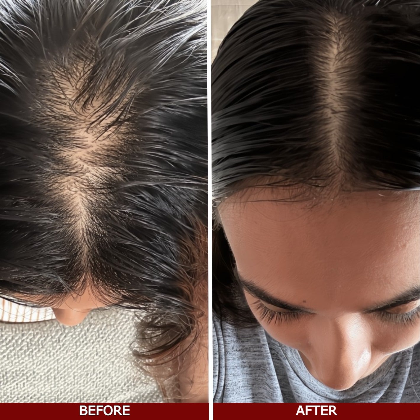Before and after comparison of hair growth on a person's head.
