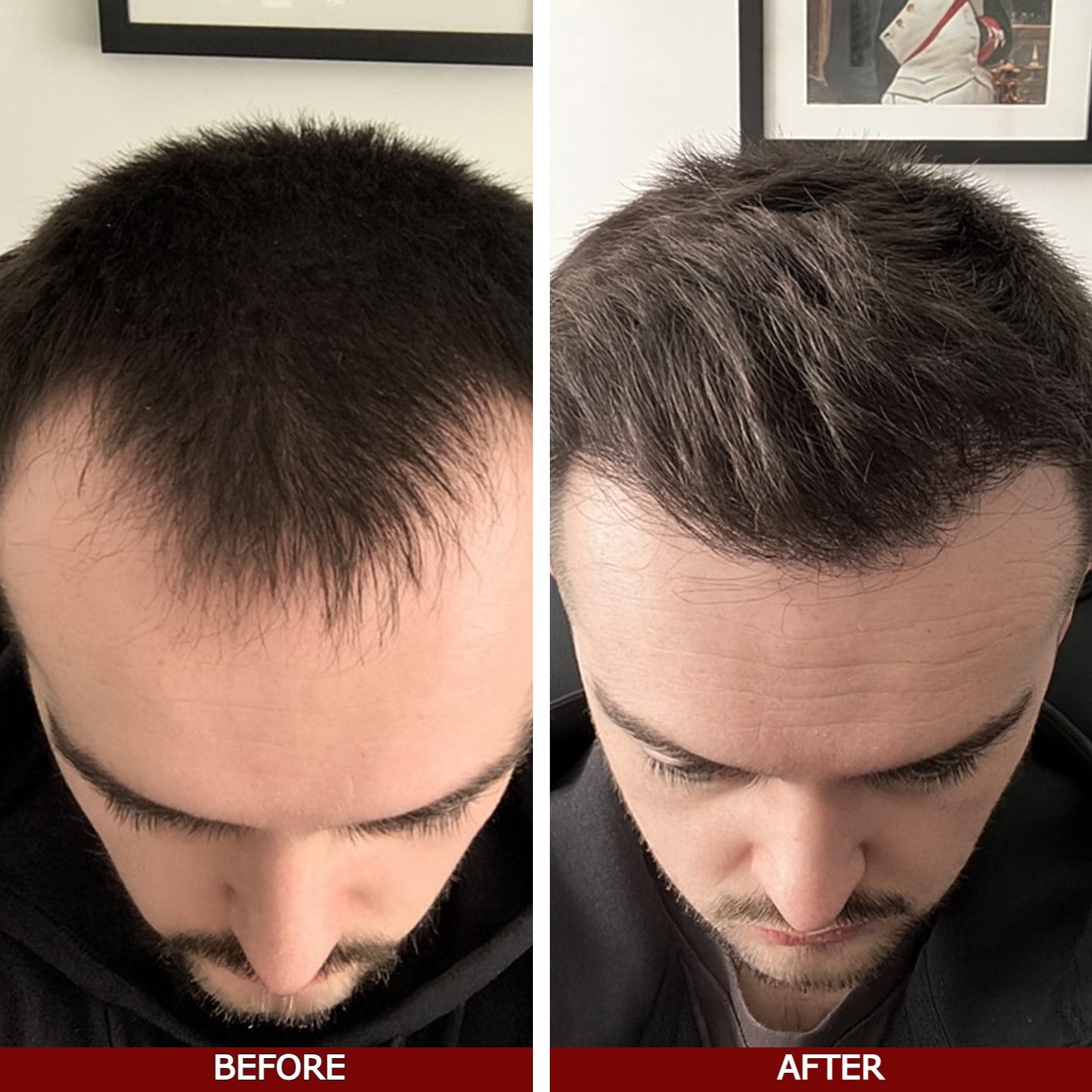 Be Bodywise Advanced Hair Growth Serum