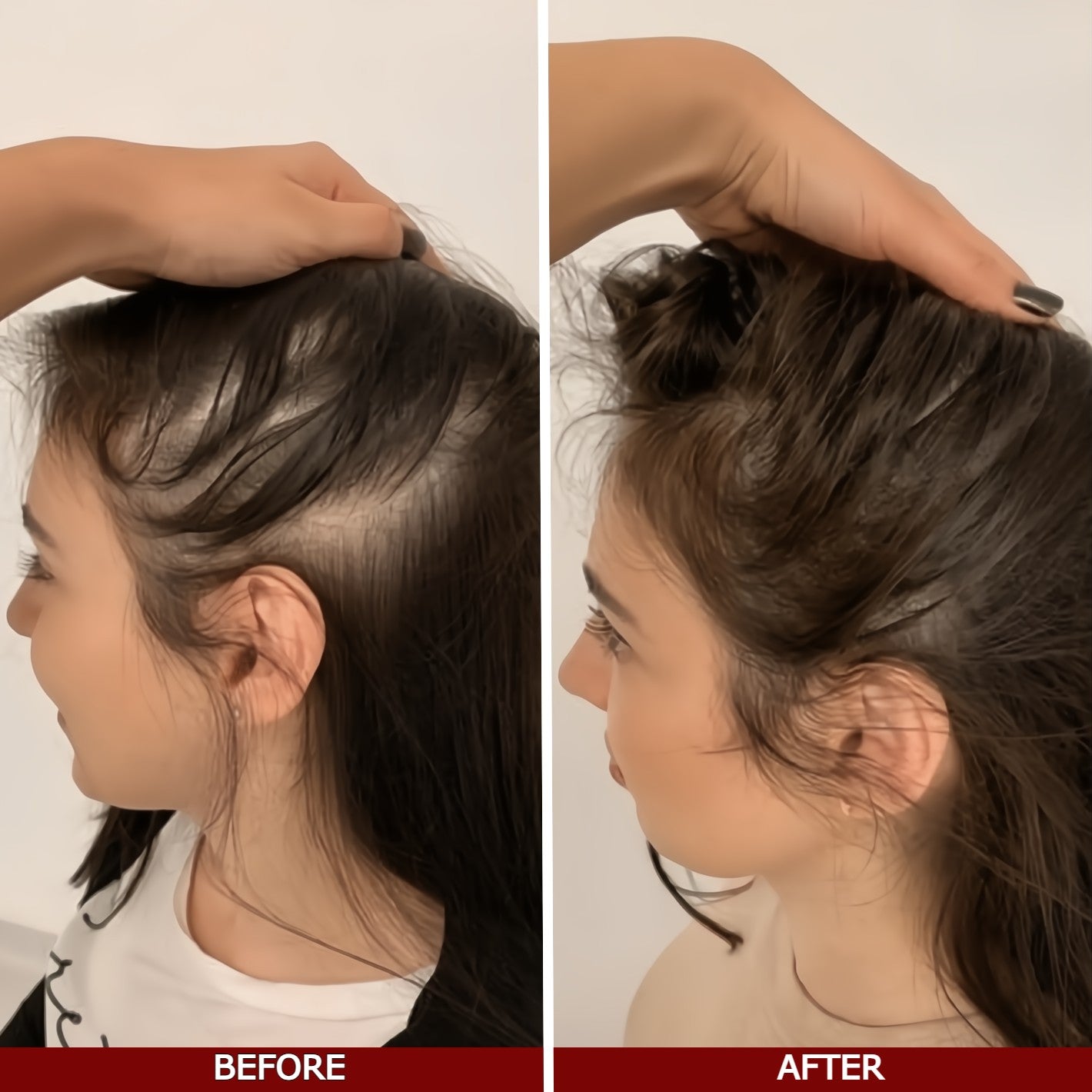Before and after comparison of hair growth on a person's head.