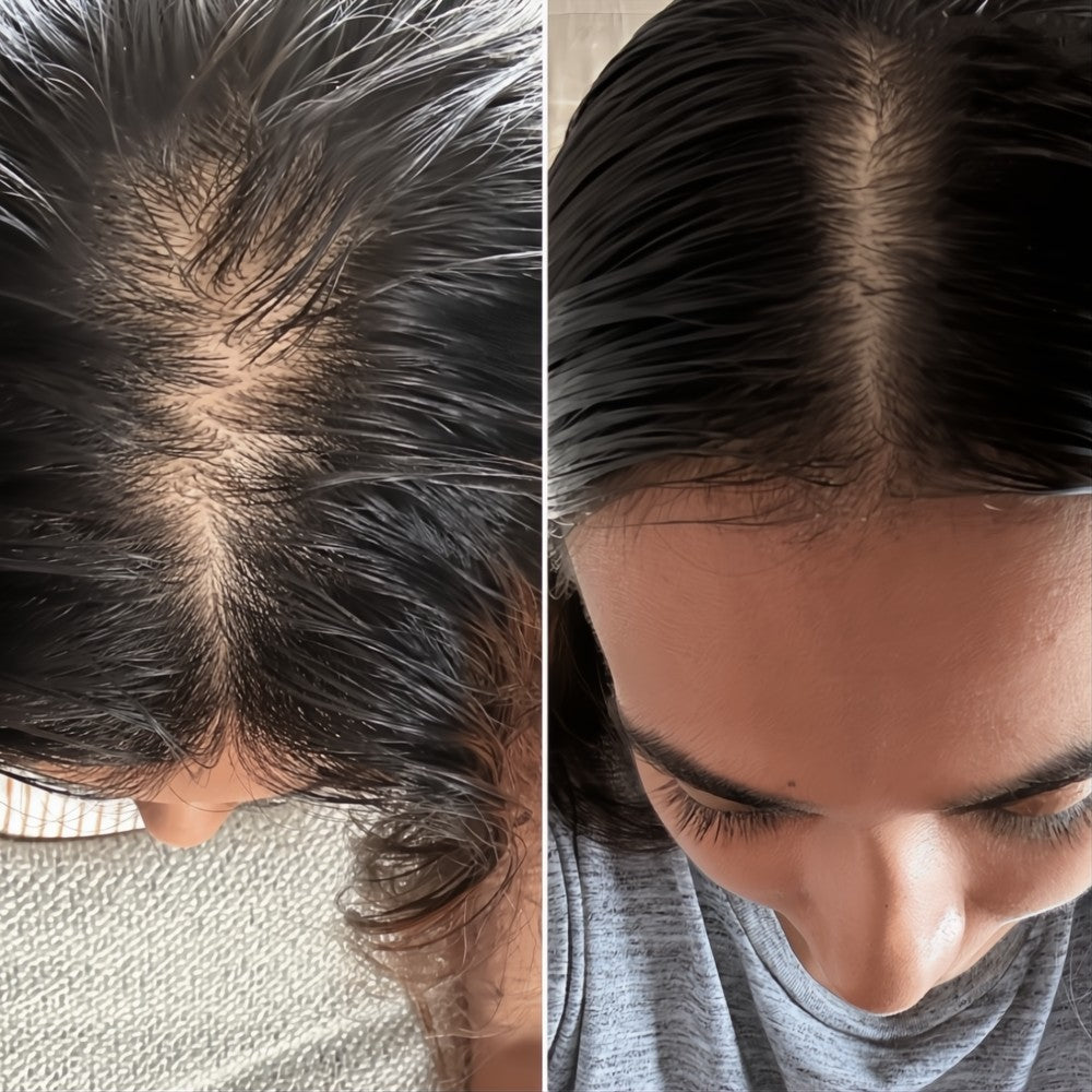 Before and after comparison of hair growth on a person's head.