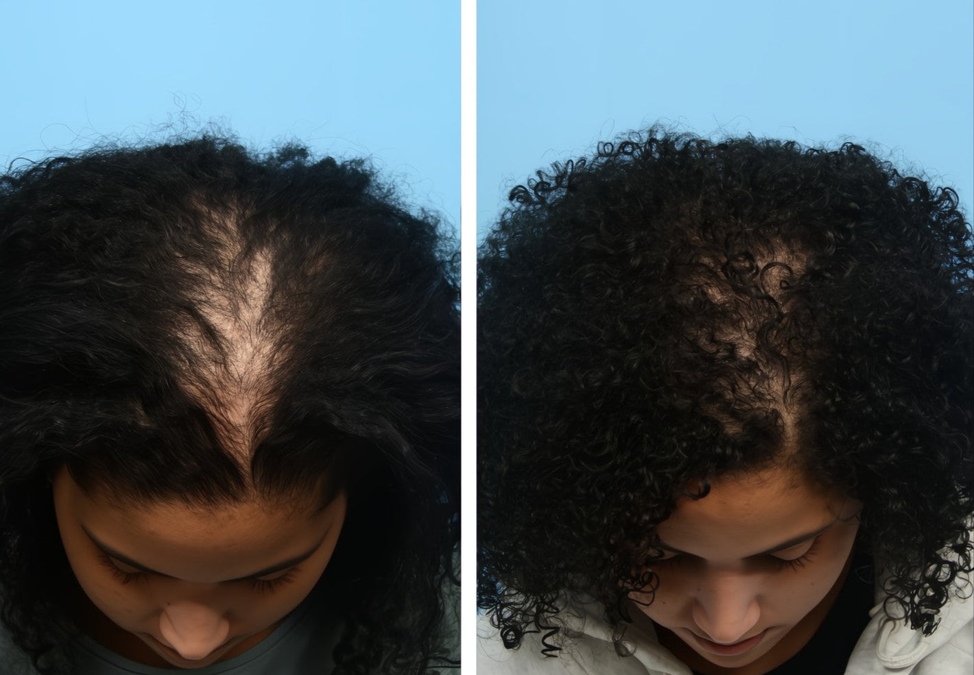 Side-by-side comparison of a person's hair before and after styling on a blue background