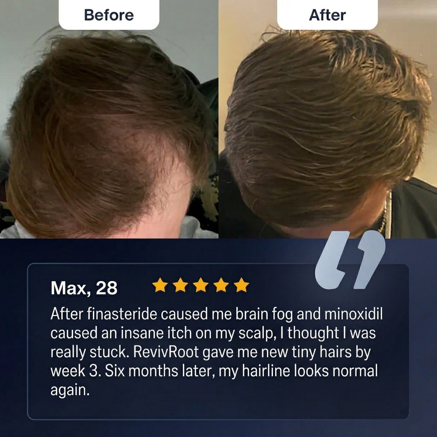 RevivRoot Advanced Hair Growth Serum