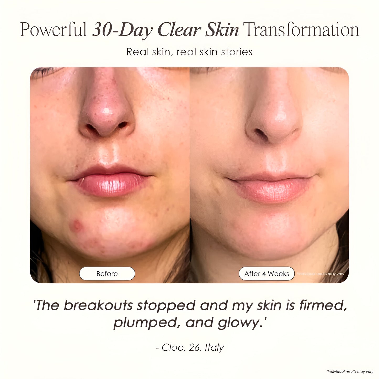 Before and after skin transformation with text on a white background