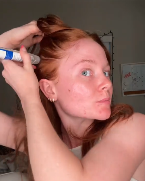 files/test1-hair-regrowth.png